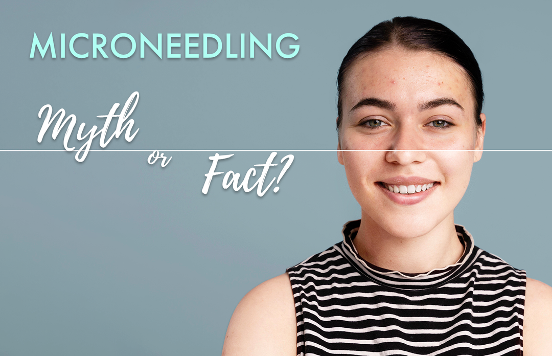 6 Myths and Facts About Microneedling