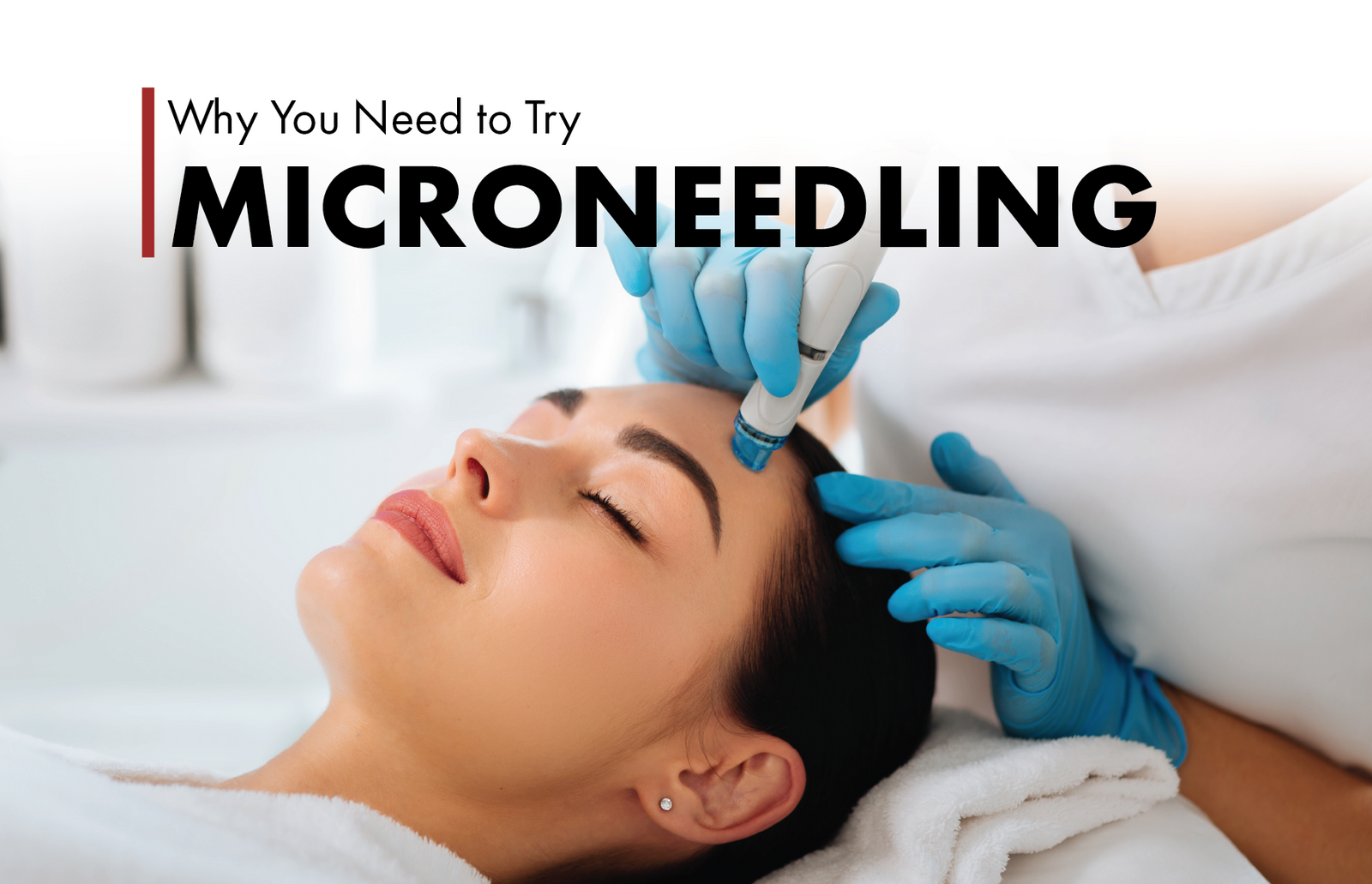 Microneedling with the DermaPen